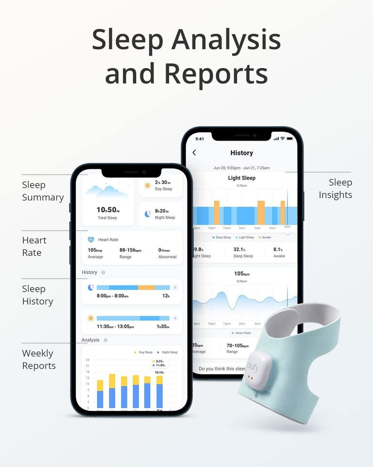 Smart S320 Sock Baby Monitor 2K Camera Track Sleep