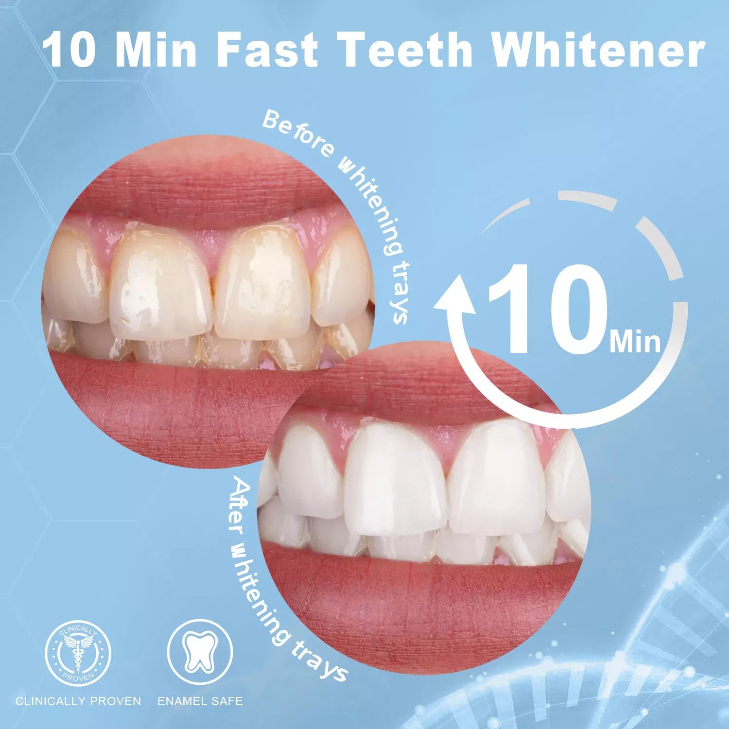 MySmile Professional Teeth Whitening Kit Non Sensitive 10Min Fast Teeth Whitener